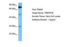 TRMT61B Antibody, Novus Biologicals 100 &mu;L; Unconjugated:Antibodies,